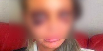 Velmi surové napadení dvou dívek šetří kriminalisté