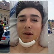 Šestnáctiletý Josef prosí o pomoc: "Srazil mě autem, vážně zranil a ujel!"