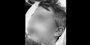 Brutálně zbitý Marek nalezený v Borské ulici dnes zemřel