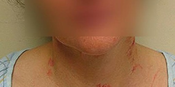 Lékař se pokusil zavraždit svoji manželku! Třetí pokus vraždy za jeden jediný týden