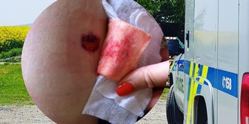 Postřelili lékařku, žena je v nemocnici