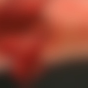 Pes napadl ženu, vážně ji zranil a mimo jiné jí i vyrval kus masa z ruky
