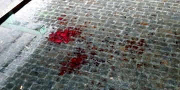 Další brutalita na Americké, ležícímu a bezbrannému muži dokonce i dupali na hlavu