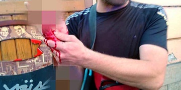 Opilý výtržník se sám bolestivě vytrestal