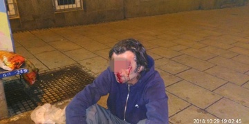 Zraněný opilec a poctivý nálezce