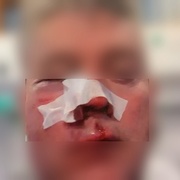 Svědek pomočení auta skončil v krvi