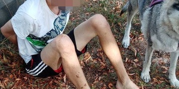 Upaloval tak, že ztratil i boty