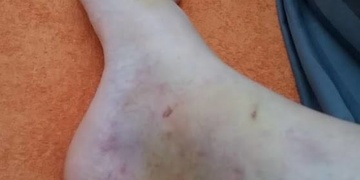 Opilá cyklistka dokázala skoro nemožné