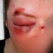 Pomozte dopadnout útočníka, který se takto vyřádil na ženě