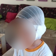 Pětiletého Vašíka na dětském dni napadl a vážně zranil pes