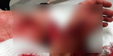 Serval muži zlatý řetízek a když se napadený bránil, vzal na něj nůž!