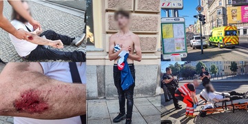 Sedmnáctiletý mladík přepadl a zranil muže v centru Plzně