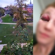 Chlapce brutálně zbili a oloupili v Mlýnské strouze