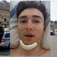 Šestnáctiletý Josef prosí o pomoc: "Srazil mě autem, vážně zranil a ujel!"
