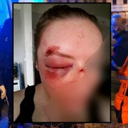 Zbitá žena v centru Plzně