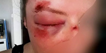 Pomozte dopadnout útočníka, který se takto vyřádil na ženě