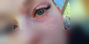 Senior zbil a zranil ženu kvůli parkování