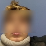Kvůli sdílení seřezal mladšího, ten skončil v nemocnici