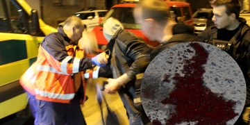 U CAN zkopali muže tak, že skončil v nemocnici s krvácením do mozku