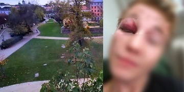 Chlapce brutálně zbili a oloupili v Mlýnské strouze