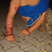 Jeden bezdomovec zraněný, druhý v celostátním pátrání