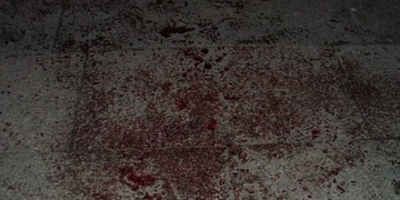 Zkopali ho do bezvědomí a když se potácel pro pomoc, další šmejdi ho okradli
