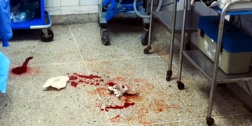 Opilec Damir v nemocnici napadl lékařku i zdravotníky