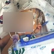 Matka těžce zranila svého pětiměsíčního chlapečka
