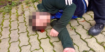 Ležel pod schody v kaluži krve