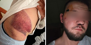 V Plzni byl nalezen brutálně zbitý muž