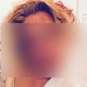 Bosá žena v panické hrůze před útočníkem vyskočila z okna