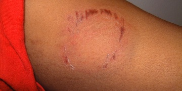 Ženu zfackoval a pokousal