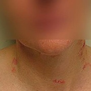 Lékař se pokusil zavraždit svoji manželku! Třetí pokus vraždy za jeden jediný týden