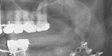 Zlomili mu čelist a v bezvědomí skončil v nemocnici