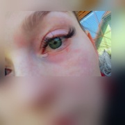 Senior zbil a zranil ženu kvůli parkování