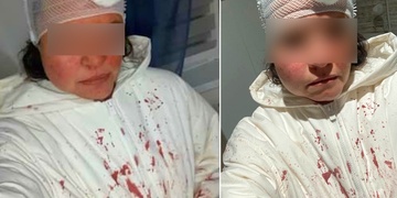 Skupina mužů brutálně napadla a zranila dvojici kolemjdoucích