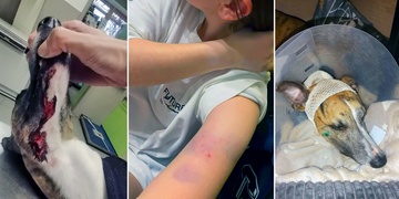 Pes napadl čtrnáctiletou dívku a vážně zranil jejího psíka - aktualizováno