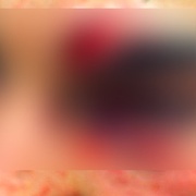 Z padesáti procent oběť navždy oslepil a ještě ji vydíral