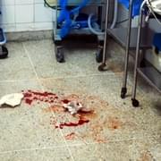 Opilec Damir v nemocnici napadl lékařku i zdravotníky