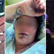 Žena spolykala hrst léků, zapila to alkoholem a odešla zemřít do pole