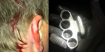 Útok boxerem na zastávce MHD