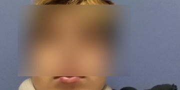 Kvůli sdílení seřezal mladšího, ten skončil v nemocnici