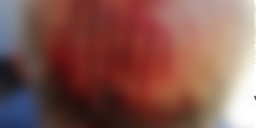 Statečná a pohotová dívka pomohla záchranářům