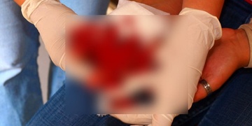 „Krev jsem zastavovala dětskými plenkami!“