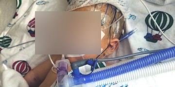 Matka těžce zranila svého pětiměsíčního chlapečka