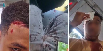 "Řekl mi, že jsem černá svině, a pak mi rozbil hlavu půllitrem!"