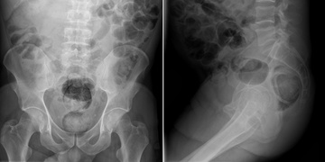 Pervitin napěchovaný v řitním otvoru aneb hodně fuj případ z Věznice Plzeň