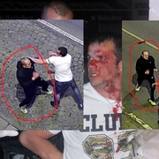 Bitka na Americké - poznáte napadeného muže?