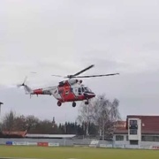Malé dítě se opařilo na hlavičce i hrudníku