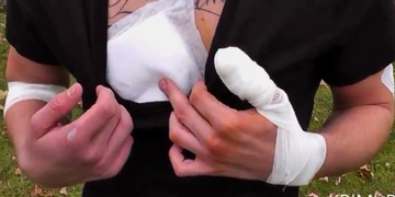 Účet za noční výlet Plzní: Čtyři řezné rány a 17 stehů!